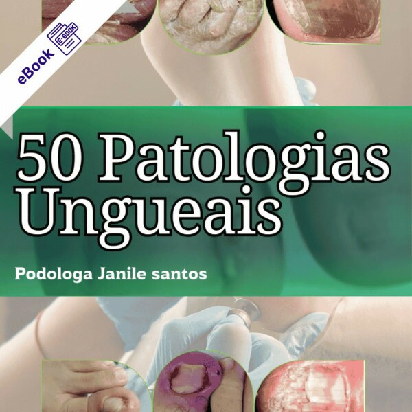 50 Patologias Ungueais: Guia Completo para Podólogos