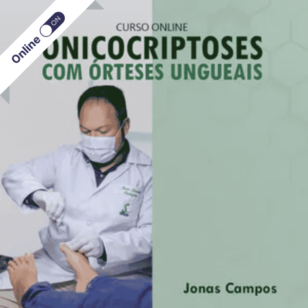 Curso de Podologia Online - Onicocriptoses e Órteses Ungueais Curso de Podologia Online - Onicocriptoses e Órteses Ungueais