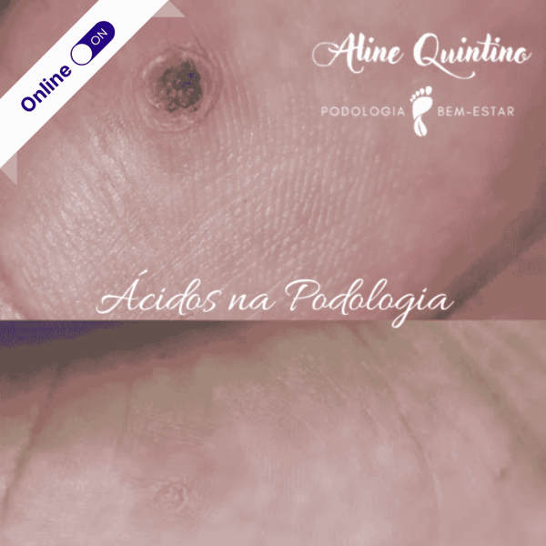 Podologia com Ácidos Podologia com Ácidos