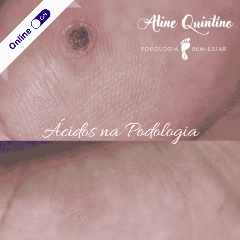 Podologia com Ácidos Podologia com Ácidos