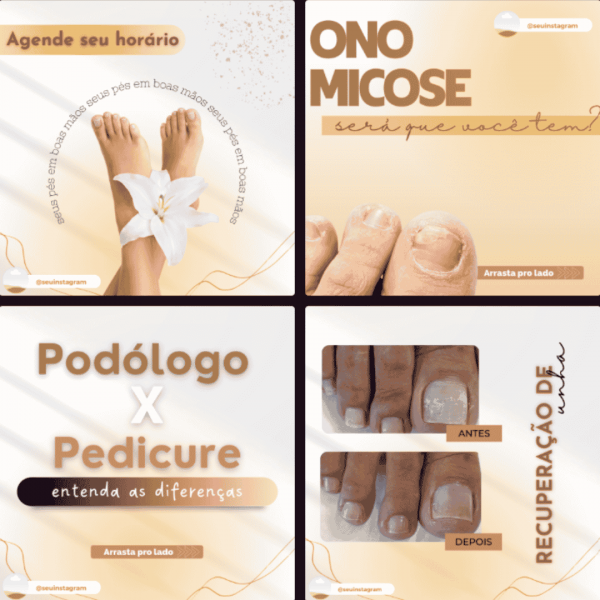 Canva para Podologia Canva para Podologia