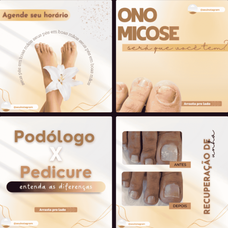 Canva para Podologia Canva para Podologia