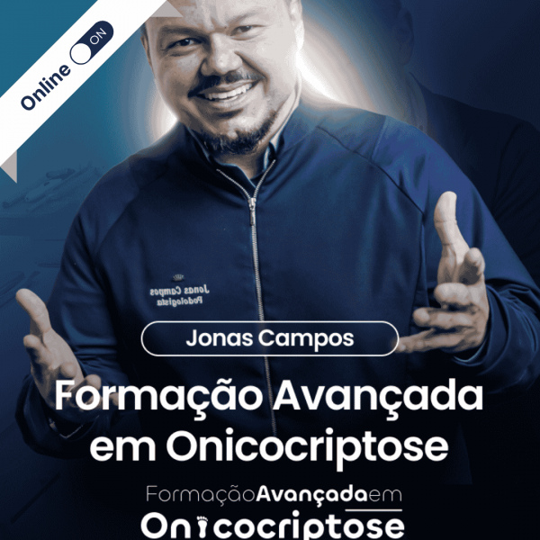 Tratamento de Onicocriptose – Formação Avançada com Jonas Campos Tratamento de Onicocriptose – Formação Avançada com Jonas Campos