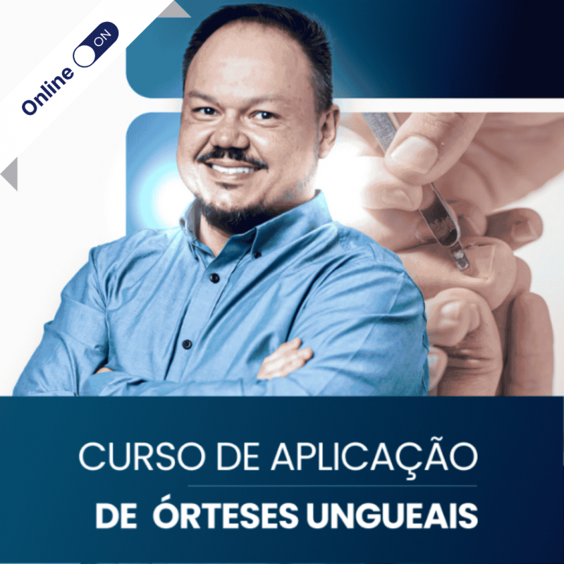 Aplicação de Órteses Ungueais na Prática com Jonas Campos Aplicação de Órteses Ungueais na Prática com Jonas Campos