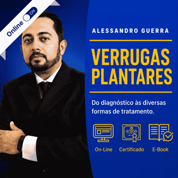 Verruga Plantar, do Diagnóstico às Várias Formas de Tratamentos com Alessandro Guerra Verruga Plantar, do Diagnóstico às Várias Formas de Tratamentos com Alessandro Guerra