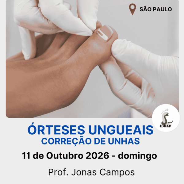 IBRAP - Órteses Ungueais com Jonas Campos