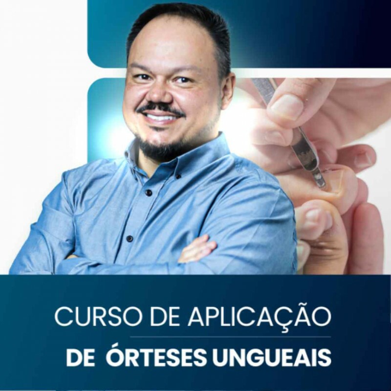 Aplicação de Órteses Ungueais na Prática com Jonas Campos