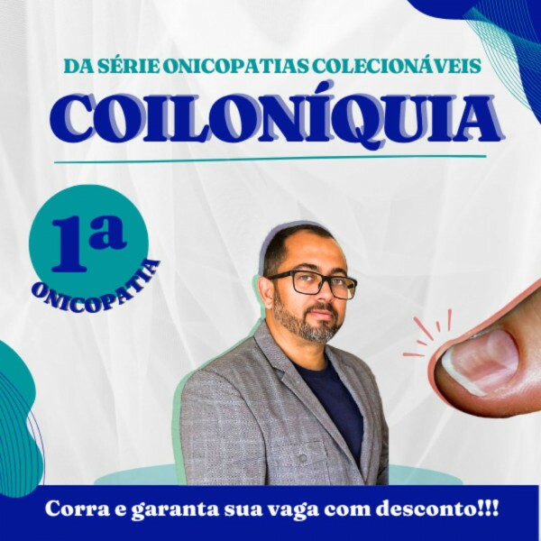 Coiloníquia — Conhecimento Completo sobre uma Onicopatia