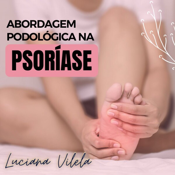 Abordagem Podológica na Psoríase