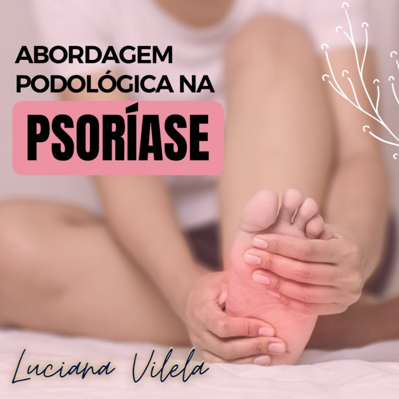 Abordagem Podológica na Psoríase Abordagem Podológica na Psoríase