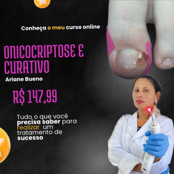 Onicocriptose e Curativos - Destrave na Podologia Onicocriptose e Curativos - Destrave na Podologia