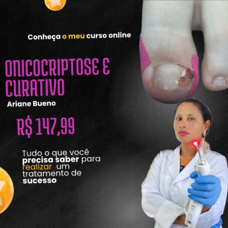 Onicocriptose e Curativos - Destrave na Podologia