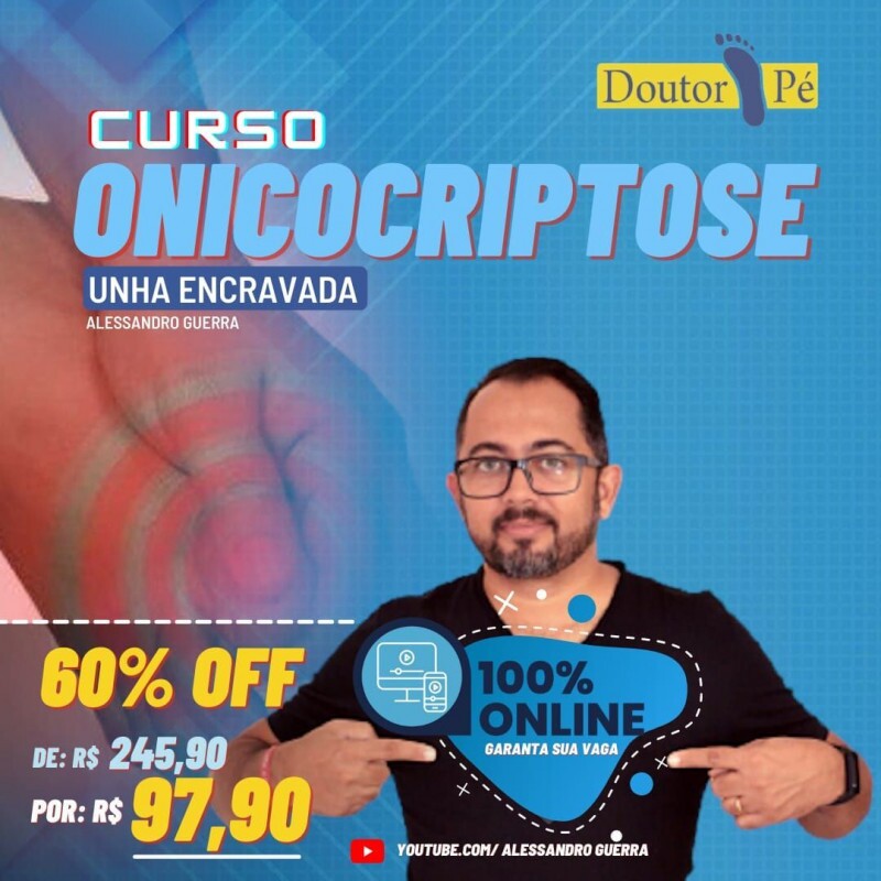 Onicocriptose e Unha Encravada: Aprenda com o Prof. Alessandro Guerra Onicocriptose e Unha Encravada: Aprenda com o Prof. Alessandro Guerra