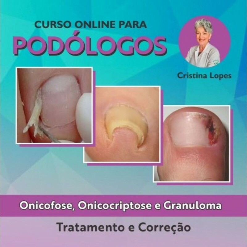 Onicofose, Onicocriptose e Granuloma com Cristina Lopes Onicofose, Onicocriptose e Granuloma com Cristina Lopes