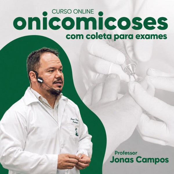 Onicomicoses e Coleta para Exames com Prof. Jonas Campos Onicomicoses e Coleta para Exames com Prof. Jonas Campos