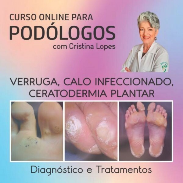 Verruga Plantar, Calo Infeccionado e Certodermia Plantar com Cristina Lopes Verruga Plantar, Calo Infeccionado e Certodermia Plantar com Cristina Lopes