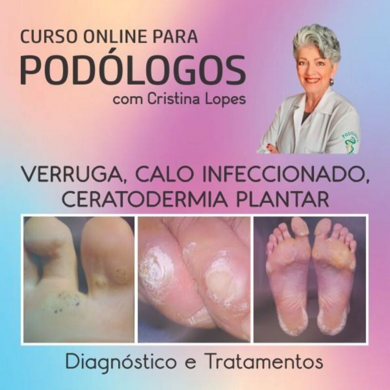 Verruga Plantar, Calo Infeccionado e Certodermia Plantar com Cristina Lopes Verruga Plantar, Calo Infeccionado e Certodermia Plantar com Cristina Lopes