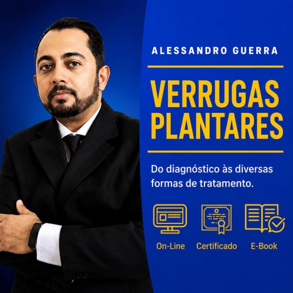 Verruga Plantar, do Diagnóstico às Várias Formas de Tratamentos com Alessandro Guerra Verruga Plantar, do Diagnóstico às Várias Formas de Tratamentos com Alessandro Guerra