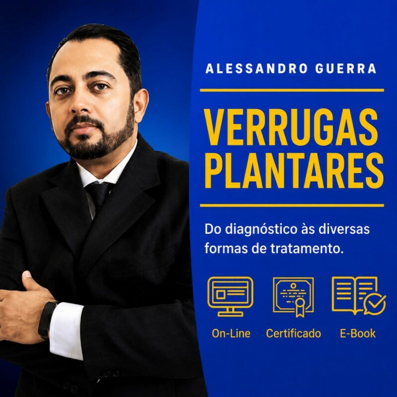 Verruga Plantar, do Diagnóstico às Várias Formas de Tratamentos com Alessandro Guerra Verruga Plantar, do Diagnóstico às Várias Formas de Tratamentos com Alessandro Guerra