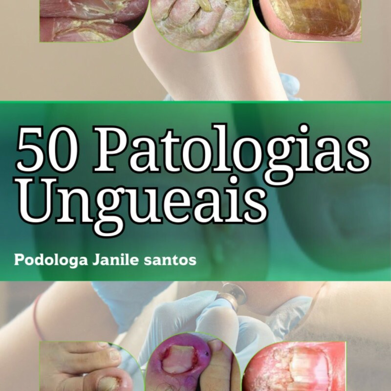50 Patologias Ungueais: Guia Completo para Podólogos