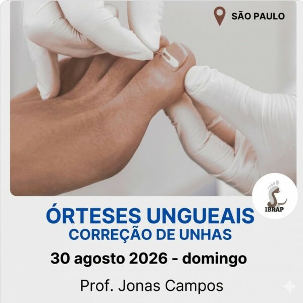 IBRAP - Órteses Ungueais com Jonas Campos IBRAP - Órteses Ungueais com Jonas Campos