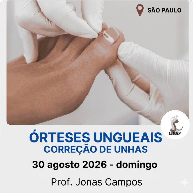 IBRAP - Órteses Ungueais com Jonas Campos