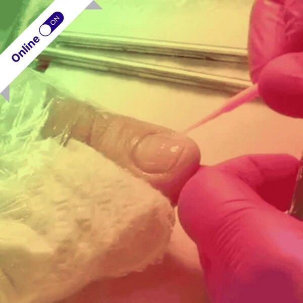 Curso de Podologia Online - Peeling e Cauterizações Curso de Podologia Online - Peeling e Cauterizações
