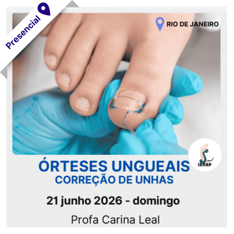 IBRAP - Órteses Ungueais com Carina Leal IBRAP - Órteses Ungueais com Carina Leal