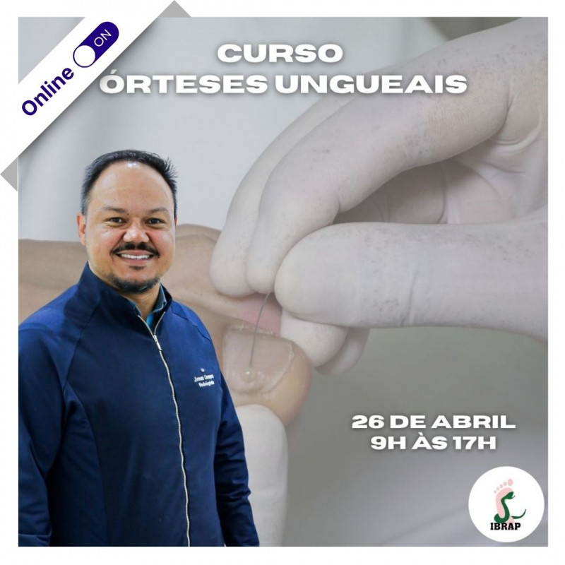 Curso Presencial - Órteses Ungueais Curso Presencial - Órteses Ungueais
