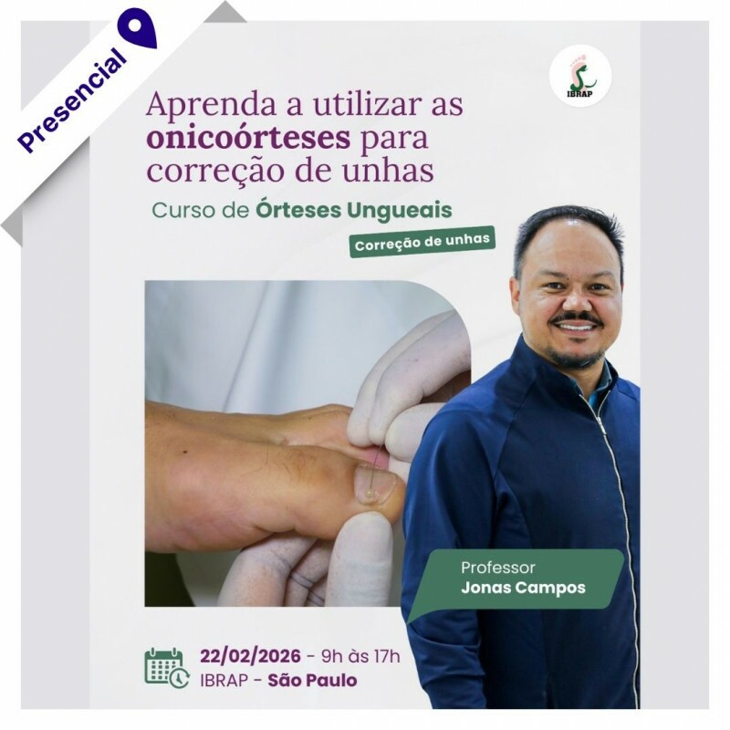 Curso Presencial - Órteses Ungueais Curso Presencial - Órteses Ungueais