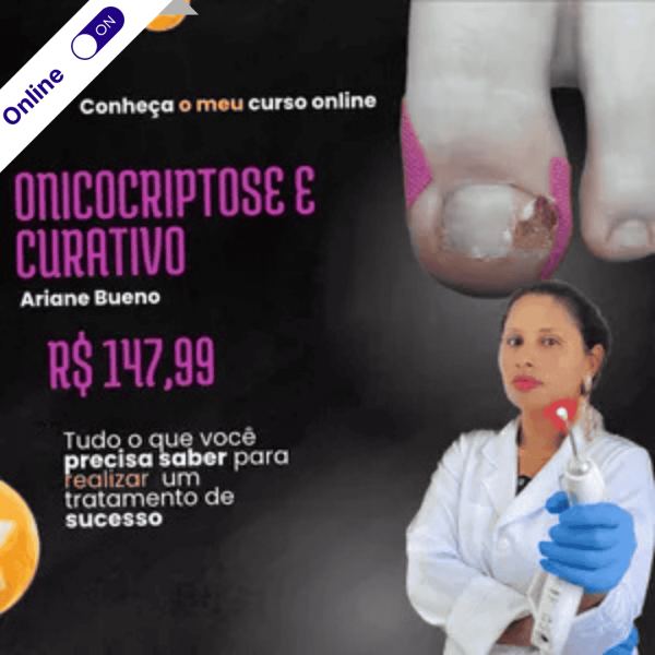 Curso de Podologia Online - Onicocriptose e Curativos - Destrave na Podologia