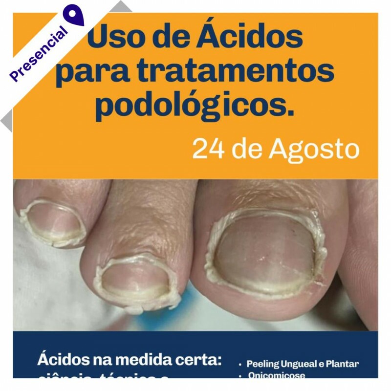 Curso Livre Presencial - Uso de Ácidos para Tratamentos Podológicos