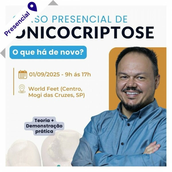 Curso de Podologia Presencial - Onicocriptose com Jonas Campos