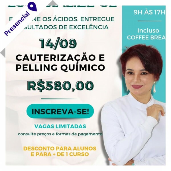 Curso de Podologia Presencial - Cauterização e Peeling Químico com Vilma Carvalho 
