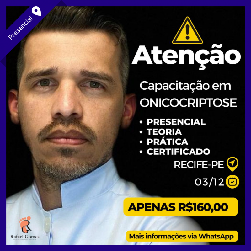 Capacitação em Onicocriptose - Rafael Gomes