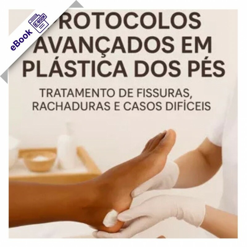 eBook de Podologia: Protocolos Avançados em Plástica dos Pés - Tratamento de Fissuras, Rachaduras e Casos Difíceis eBook de Podologia: Protocolos Avançados em Plástica dos Pés - Tratamento de Fissuras, Rachaduras e Casos Difíceis
