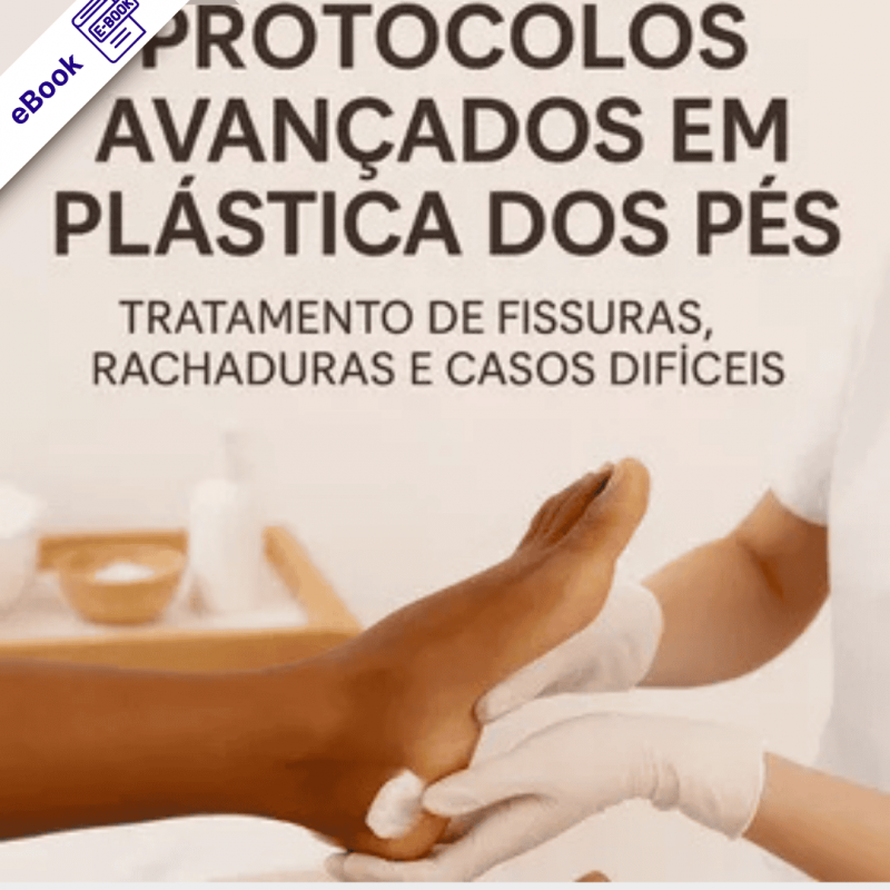 eBook de Podologia:  Protocolos Avançados em Plástica dos Pés -  Tratamento de Fissuras, Rachaduras e Casos Difíceis