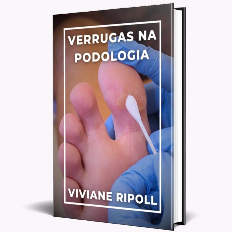 Verrugas na Podologia - Viviane Ripoll