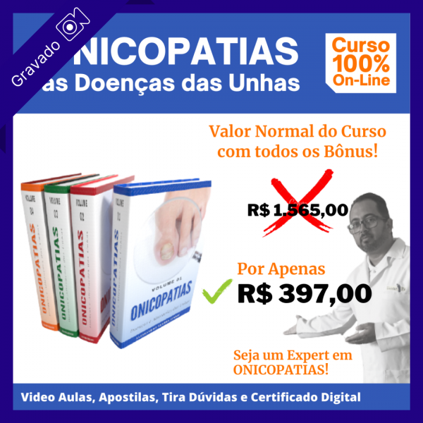 Onicopatias, as Doenças e Alterações das Unhas - Alessandro Guerra | DoutorPé