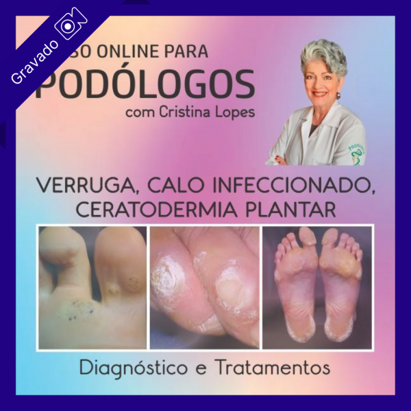 Verruga Plantar, Calo Infeccionado e Certodermia Plantar - Diagnóstico e Tratamentos - Cristina Lopes