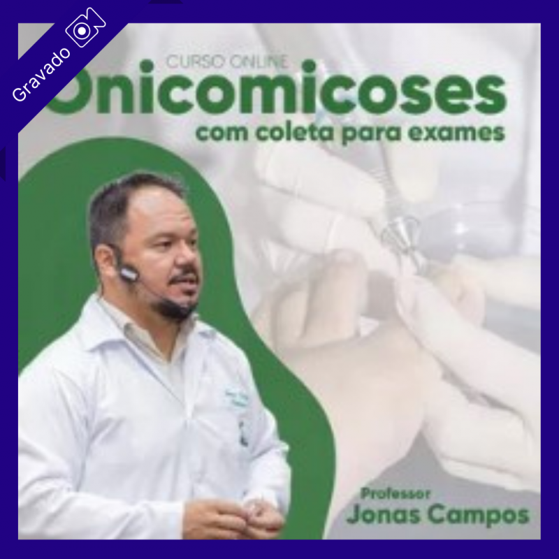 Onicomicoses , com coleta para exames - Jonas Campos