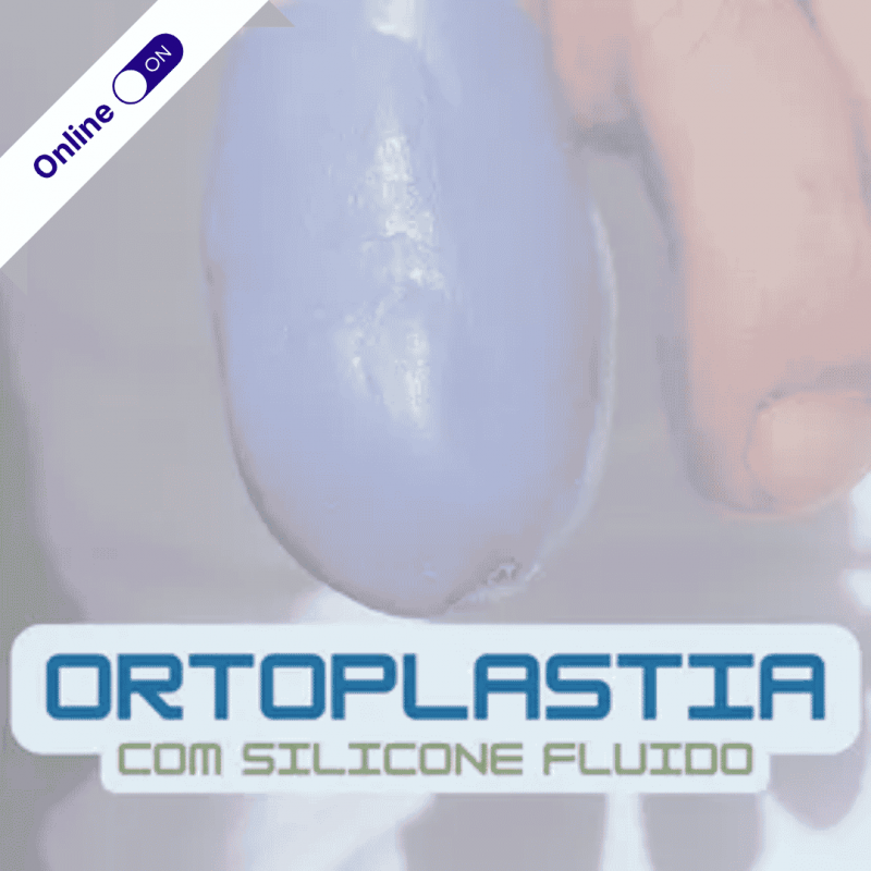 Curso de Podologia Online - Ortoplastia com Silicone Fluido