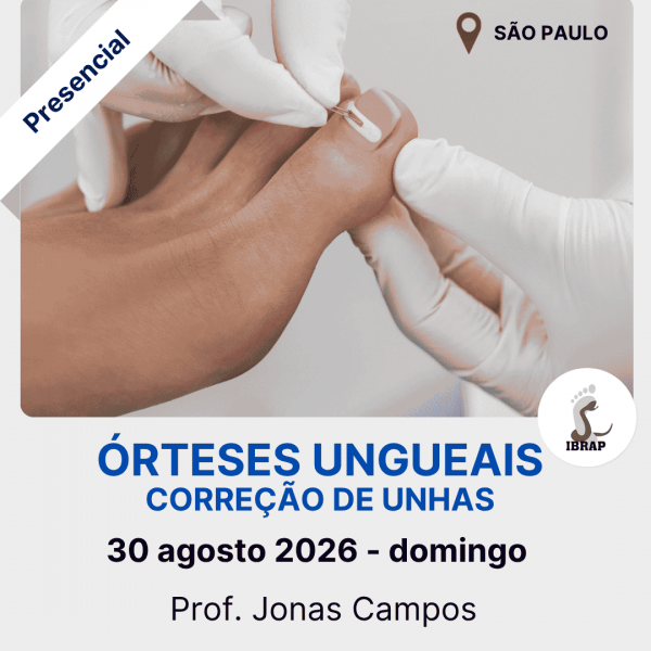 IBRAP - Órteses Ungueais com Jonas Campos IBRAP - Órteses Ungueais com Jonas Campos