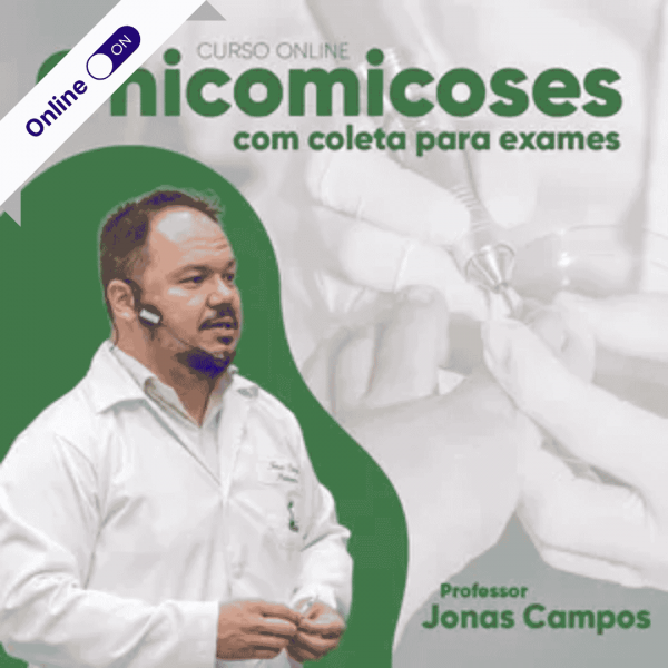 Curso  de Podologia Online - Onicomicoses e Coleta para Exames