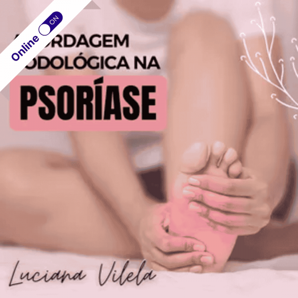 Curso de Podologia Online - Abordagem Podológica na Psoríase