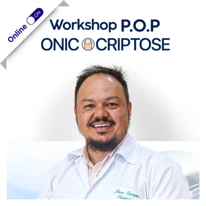 Workshop POP de Onicocriptose com Jonas Campos