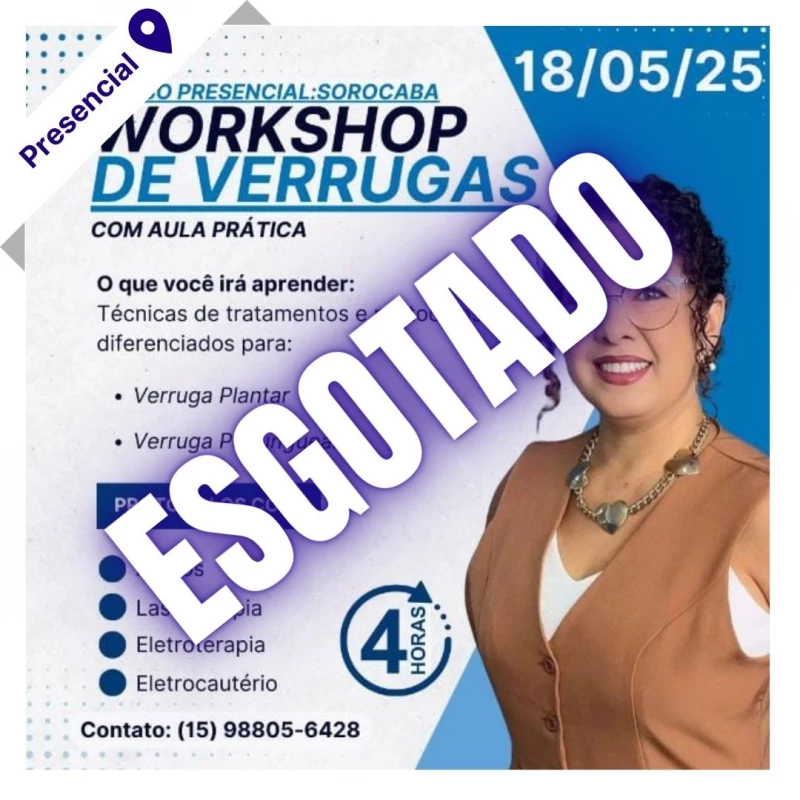 Curso de Podologia Presencial - Workshop de Verrugas com Aula Prática